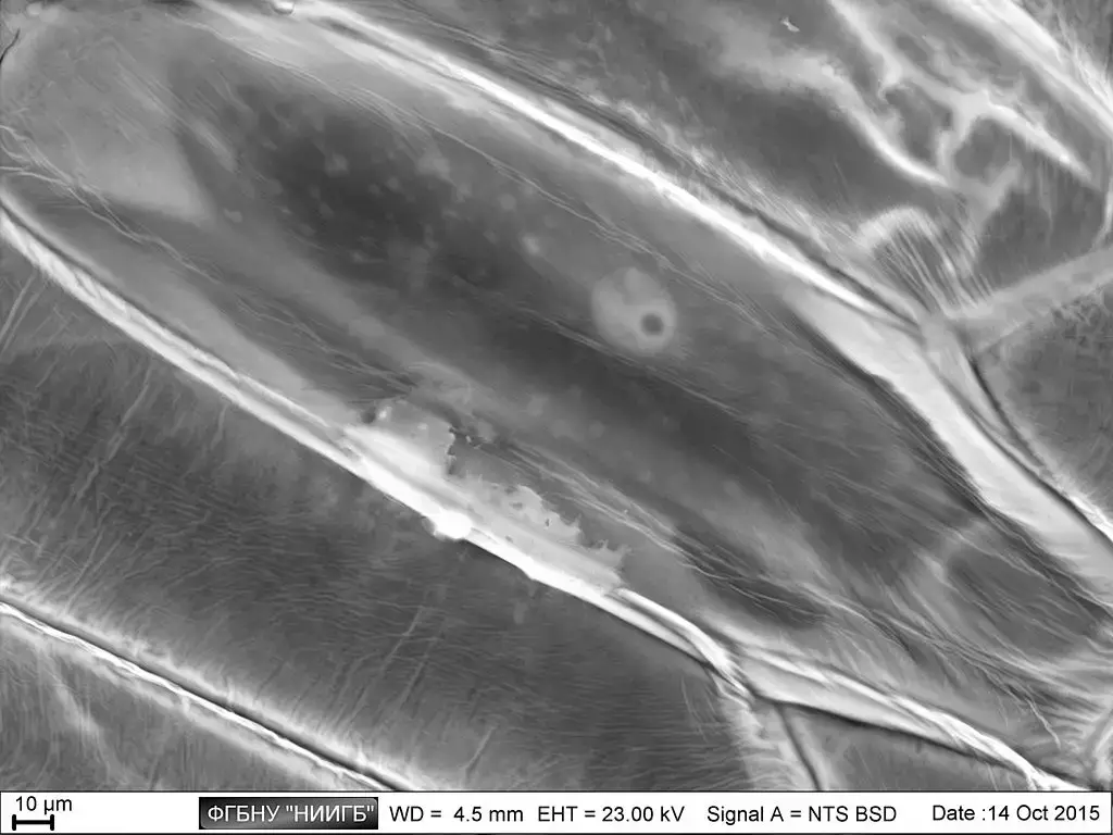 Scanning Electron Microscope (SEM) Images – Epidermal cells from the inner surface of an onion flake. Beneath the shagreen-like cell walls one can see nuclei and small organelles floating in the cytoplasm. This BSE-image of a lanthanoid-stained sample was taken without prior fixation, nor dehydration, nor sputtering.