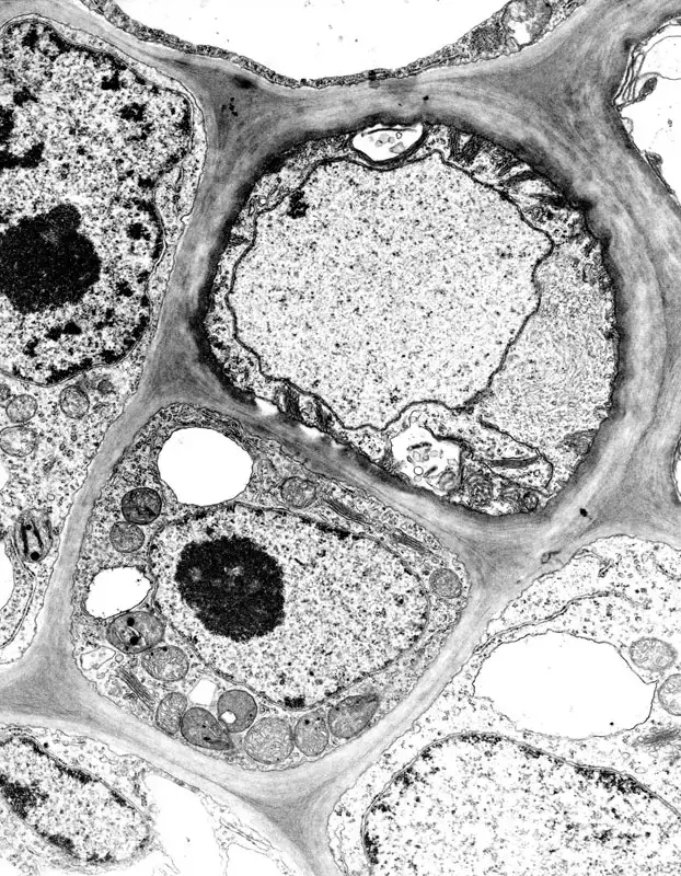 Enlarged image of cotton phloem tissue showing a sieve element (top cell) and a companion cell (bottom cell), TEM x8,000. Photo by J. Thorsch.