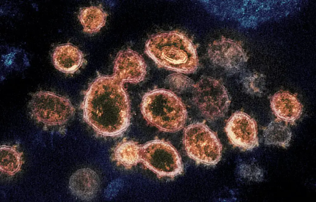 This transmission electron microscope image shows SARS-CoV-2, the virus that causes COVID-19, isolated from a patient in the U.S. Virus particles are shown emerging from the surface of cells cultured in the lab. The spikes on the outer edge of the virus particles give coronaviruses their name, crown-like. Image captured and colorized at NIAID’s Rocky Mountain Laboratories (RML) in Hamilton, Montana. Credit: NIAID