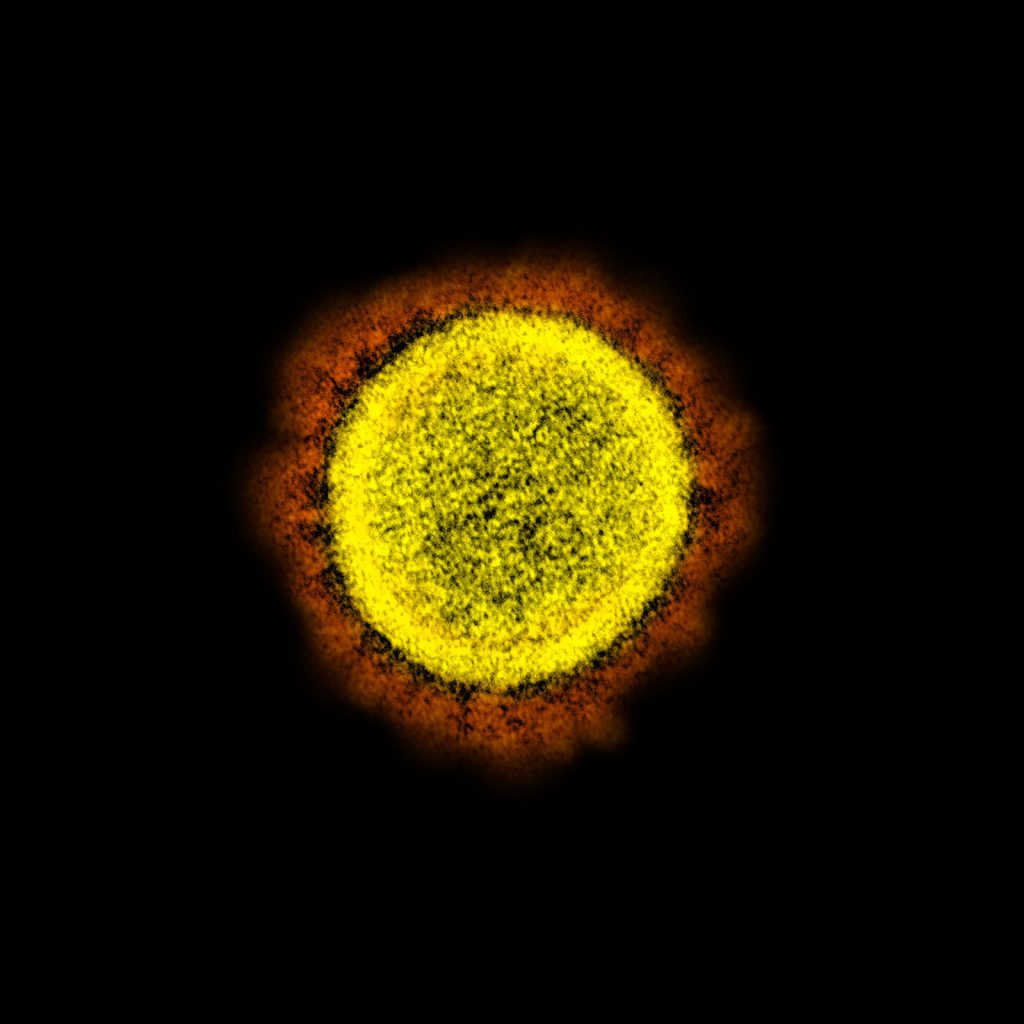 Transmission electron micrograph of SARS-CoV-2 virus particles, isolated from a patient. Image captured and color-enhanced at the NIAID Integrated Research Facility (IRF) in Fort Detrick, Maryland. Credit: NIAID