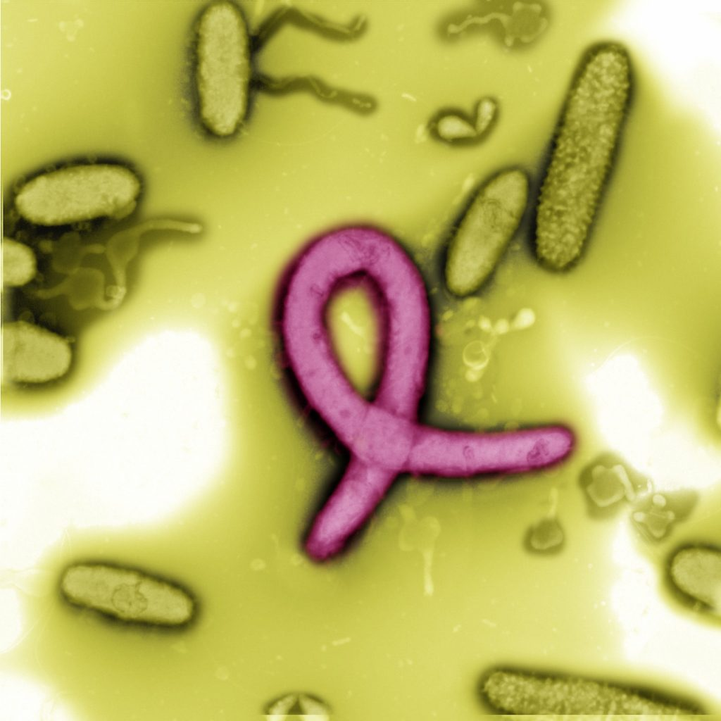 Methylotenera sp. is a bacterial strain isolated from Hanford 300A sediment. A bacterial cell that happened to be folded at the moment of sampling is reminiscent of a meaningful symbol. It was imaged with Tecnai T-12 transmission electron microscope, or TEM (FEI). Team members: Alice Dohnalkova, Dave Kennedy, Mike Wilkins and Allan Konopka Image was captured using instrumentation at EMSL, a U.S. Department of Energy national user facility at Pacific Northwest National Laboratory. Research funded by DOE Office of Biological & Environmental Research. Image was captured and colorized by Alice Dohnalkova.