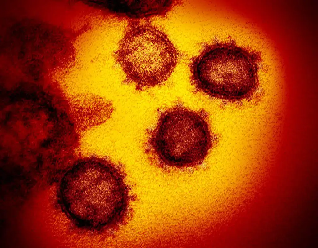 This transmission electron microscope image shows SARS-CoV-2—also known as 2019-nCoV, the virus that causes COVID-19. isolated from a patient in the U.S., emerging from the surface of cells cultured in the lab. Credit: National Institute of Allergy and Infectious Diseases-Rocky Mountain Laboratories, NIH