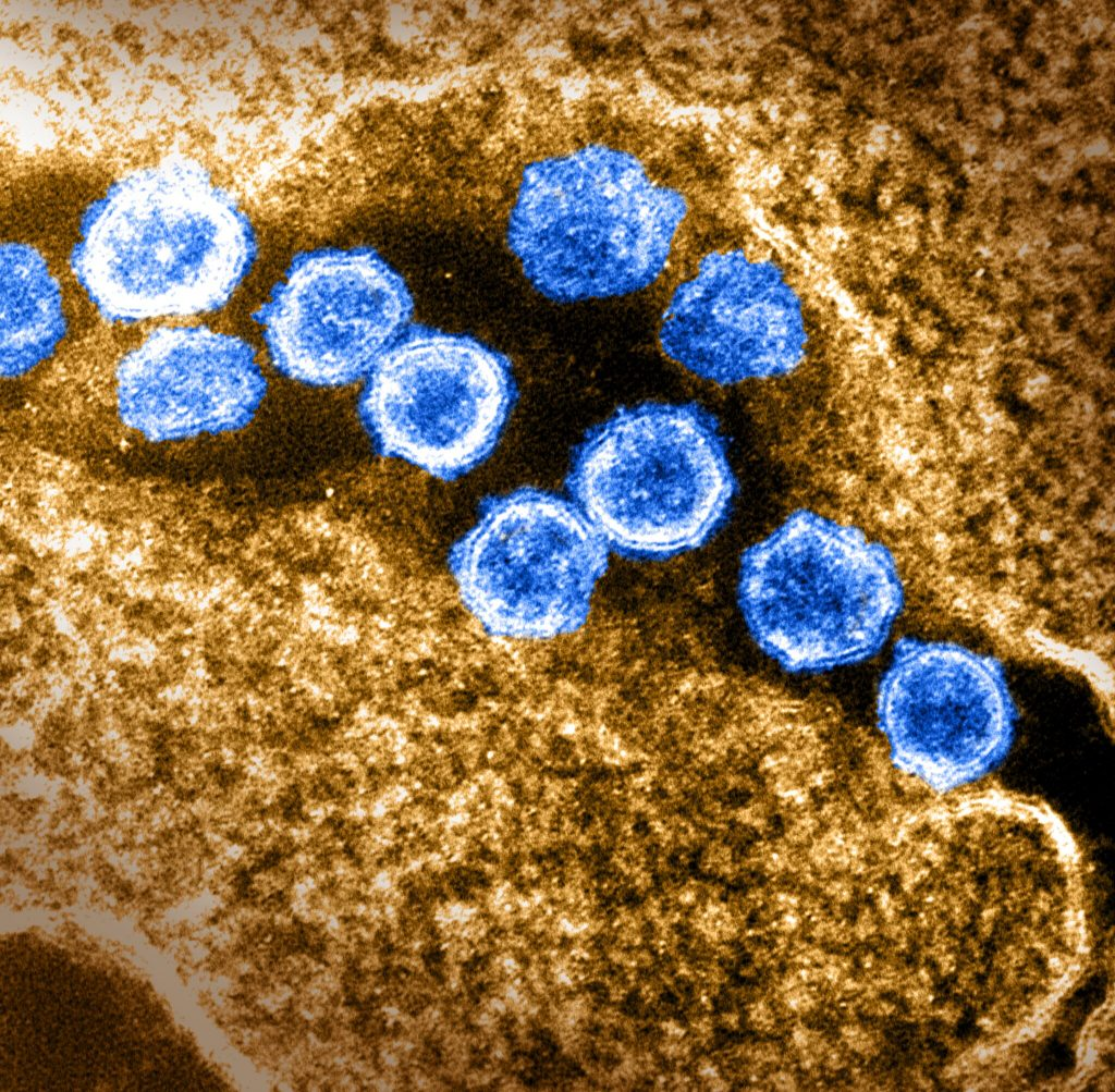 This transmission electron microscope image shows SARS-CoV-2—also known as 2019-nCoV, the virus that causes COVID-19. Virus particles are shown emerging from the surface of a cell cultured in the lab. The spikes on the outer edge of the virus particles give coronaviruses their name, crown-like. Image captured and colorized at Rocky Mountain Laboratories in Hamilton, Montana. Credit: NIAID