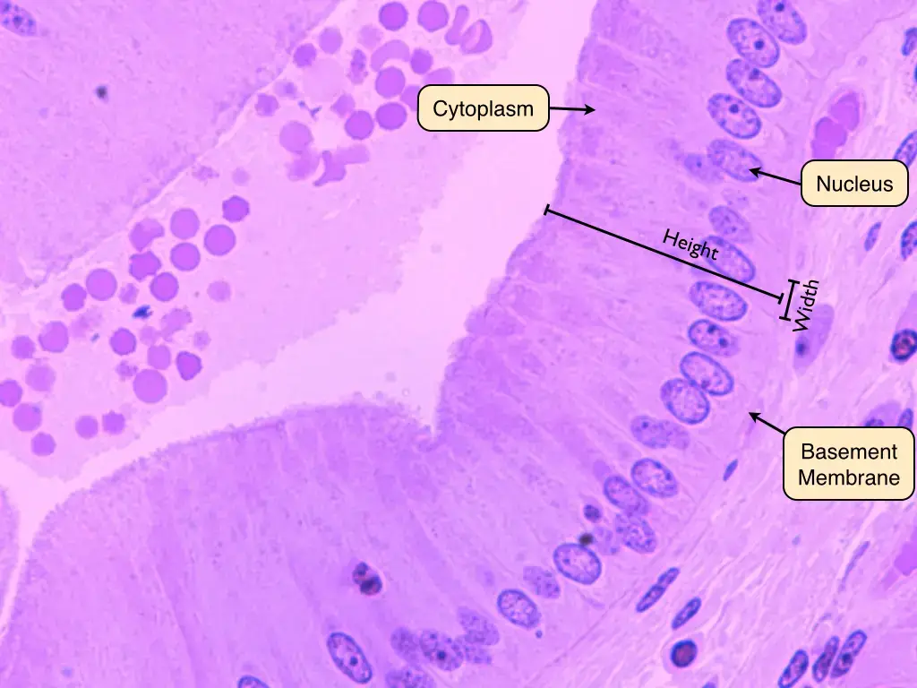 Simple columnar epithelium under microscope
