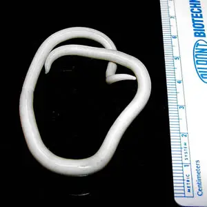 Ascaris lumbricoides
