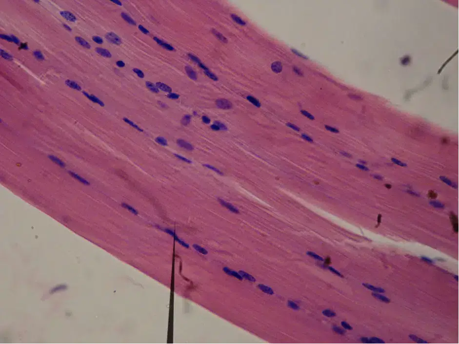 Smooth muscle fibres
