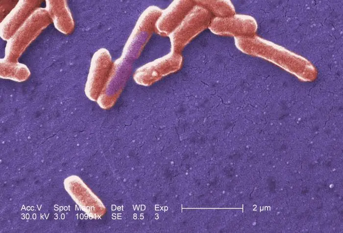 Scanning electron micrograph of an E. coli colony.