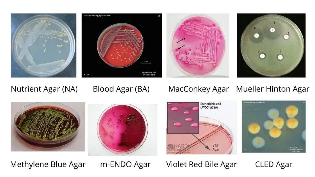 Escherichia coli(E. coli) morphology, arrangement, Cultural ...