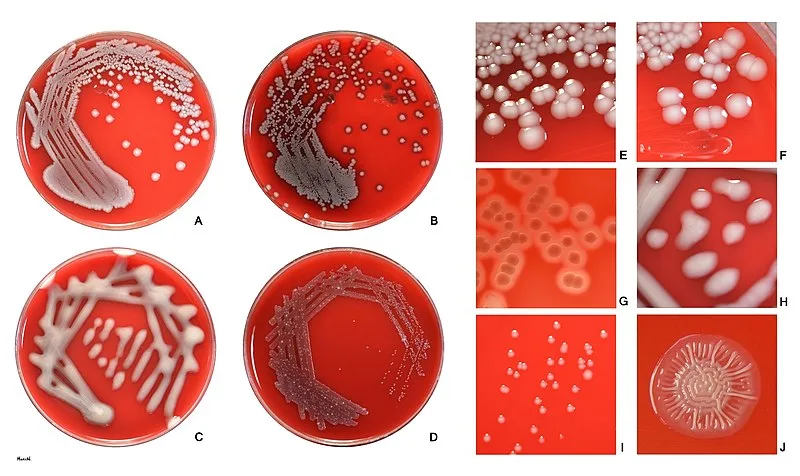 Escherichia coli(E. coli) morphology, arrangement, Cultural Characteristics, Diagnosis 4 E. coli on sheep blood agar.