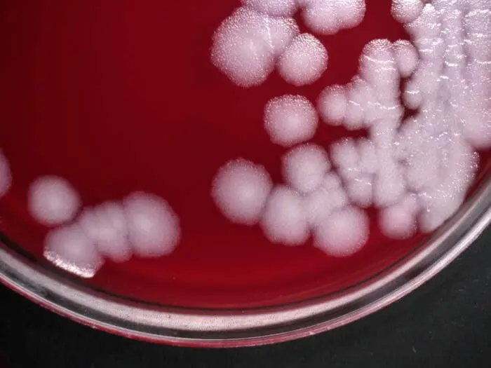 Bacillus anthracis, which were cultured on sheep blood agar (SBA) medium, for a 24-hour time period, at a temperature of 37°C. 