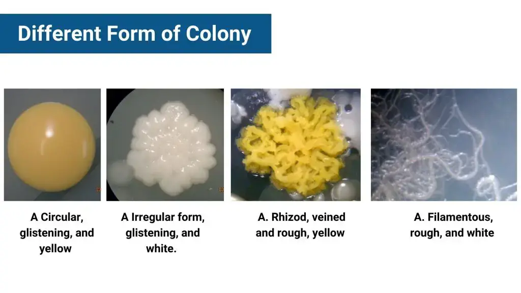 Colony Morphology of Bacteria and Examples - Biology Notes Online