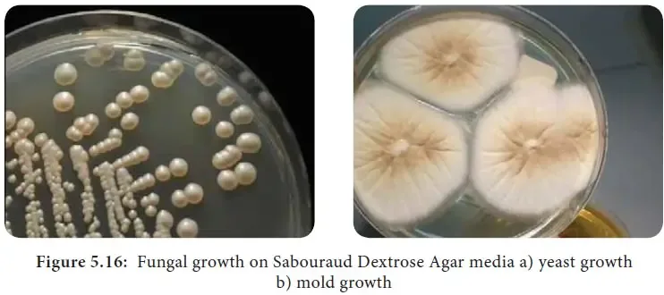 Colony Morphology of Bacteria and Examples
