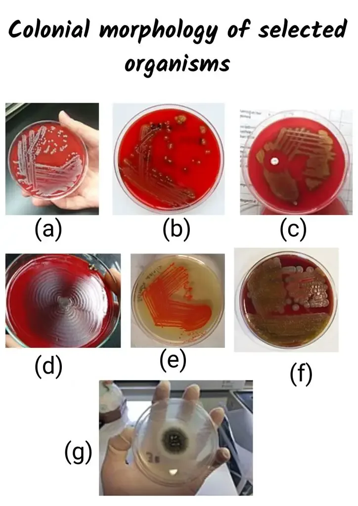 (a) Staphylococcus aureus: large opaque, round, creamy, white to yellowish colonies displaying beta-hemolysis on blood agar, (b) Streptococcus pyogenes: small translucent colonies displaying beta-hemolysis on blood agar, (c) Streptococcus pneumoniae: small colonies with raised edges displaying alpha-hemolysis on blood agar, (d) Proteus sp.: swarming behaviour on blood agar, (e) Serratia marcescens: red pigmentation: although considered characteristic of the species, only about 10% of specimens produce this pigment, (e) Bacillus cereus: “ground-glass” colonies displaying beta-hemolysis on blood agar, (f) Aspergillus niger: granular colonies with a white edge and central black pigmentation