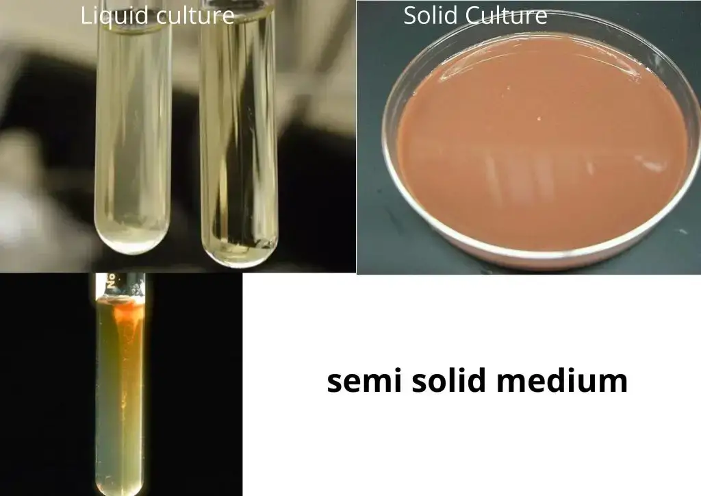 Classification of Bacterial Culture Media Based on Consistency 