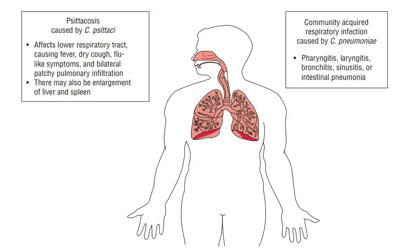 Clinical manifestations caused by Chlamydophila psittaci and Chlamydophila pneumoniae