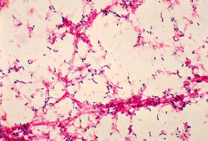 Streptococcus pneumoniae Gram-stain of blood broth culture. CDC.