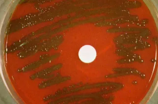 Streptococcus pneumoniae - Habitat, Morphology, Genomes 5 Streptococcus pneumoniae A mucoid strain on blood agar showing alpha hemolysis (green zone surrounding colonies). Note the zone of inhibition around a filter paper disc impregnated with optochin. Viridans streptococci are not inhibited by optochin.