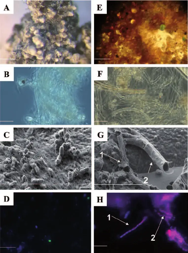 Dissecting microscope images – (A) Picture of a S aggregate under a dissecting microscope (A) on a white mat. The bar represents 1 mm on the scale. (B)  Picture of S filaments on a white mat in phase contrast. The bar represents 10 m in actual size. A high-resolution scanning electron micrograph (SEM) image showing filaments and related cells in the white mat (C). Arc94-targeted cells, as seen in fluorescent in situ hybridization (FISH) image (D) (green). A photograph of flakes of iron oxide (Fe oxide) found in an orange carpet. The bar represents 1 mm on the scale. An orange flake as seen using a light microscope in (F). (G) A magnified SEM picture of a flake with broken sheaths. The arrows denote two types of hidden microorganisms (the bacteria themselves are not visible,
