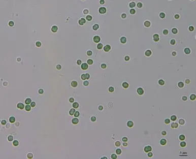 Cyanobacteria Under Microscope – Cell morphology of the cyanobacterium AngS1 observed under a light microscope 