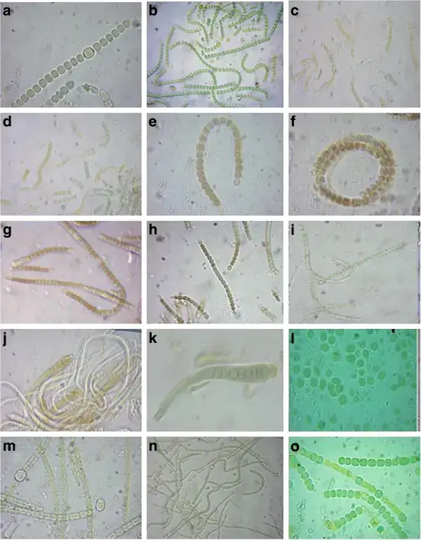 Cyanobacteria Under Microscope – Cyanobacterial strains under microscope: a.Nostoc spongiforme;b. Nostoc spongiforme;c. Nostoc sp.;d. Nostoc sp.;e. Anabaenopsis sp.;f. Anabaena circularis;g. unidentified;h. Anabaena roxburgii;i. Anabaena variabilisj. Calothrix sp.;k. Microchaetae sp.;l. Gleocapsa sp.;m. Nostoc muscorum;n. Anabaena sp.;o. Anabaena sp.