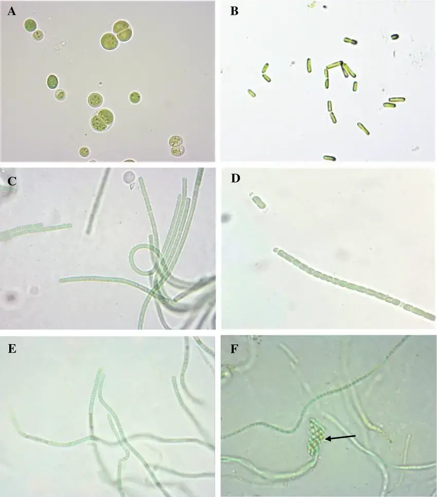 Cyanobacteria Under Microscope – Light microscope images of isolated unicellular and filamentous cyanobacteria under 100 × a Putative Chroococcales, b Putative Synechococcales, cArthronema africanum, dCalothrix, eLeptolyngbya spp., fNodosilinea showing nodule formation (arrow)