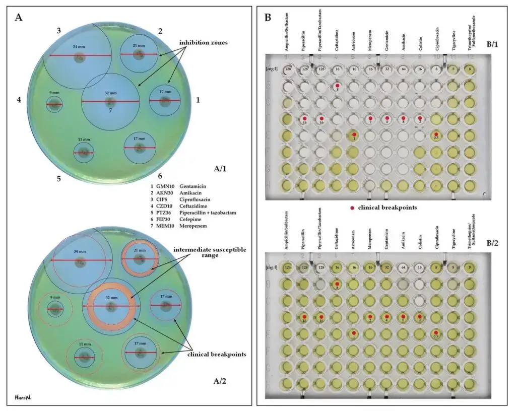 Examples of antibiotic susceptibility testing of P. aeruginosa. The disk diffusion test (A) and the MIC test (B). P. aeruginosa is intrinsically resistant to ampicillin/sulbactam, tigecycline and trimethoprim/sulfamethoxazole (no breakpoints in Img. B). [HansN., CC BY-SA 4.0, via Wikimedia Commons]