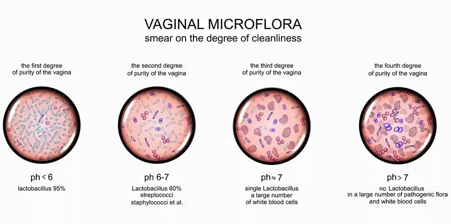 Healthy and infected vaginal flora