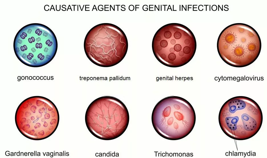 Most common STD causes