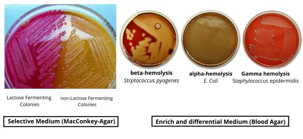 Culture Medium – MacConkey-Agar and Blood Agar