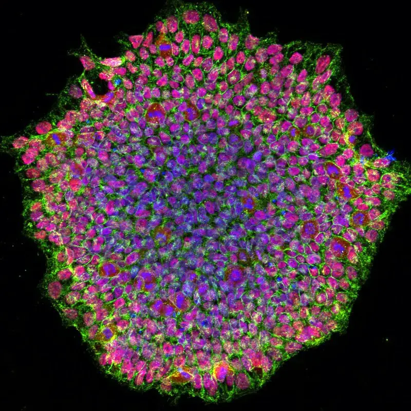 Confocal microscope image – Human induced pluripotent stem cell colony