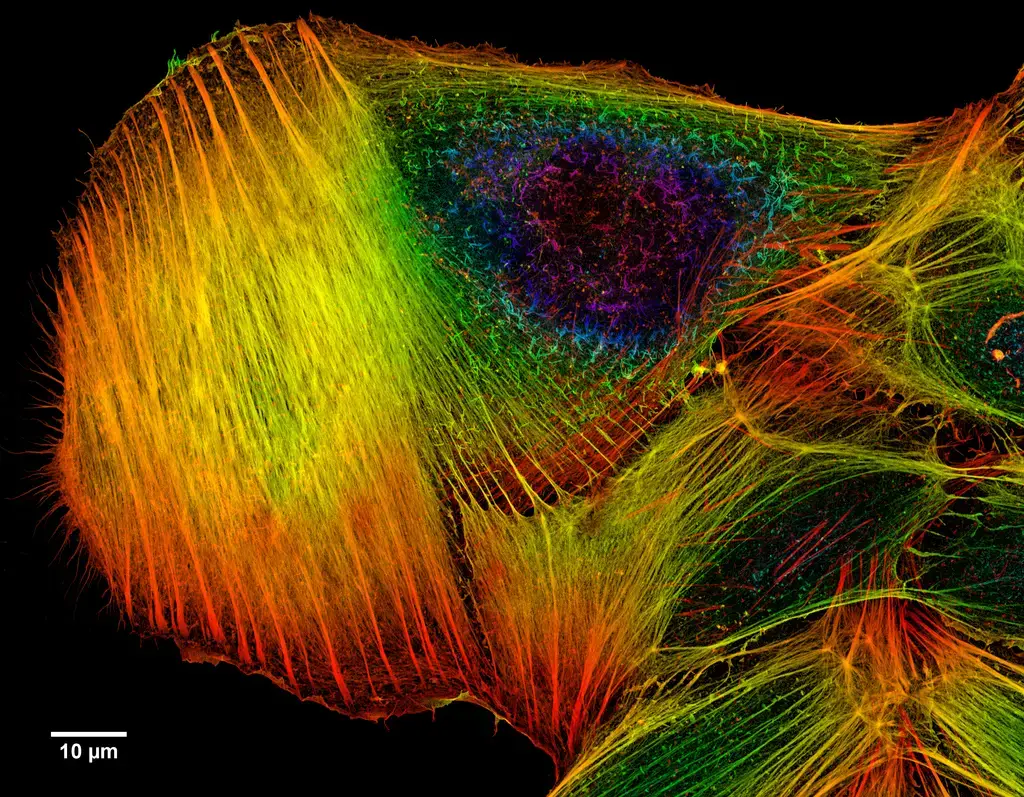 Confocal Microscope Principle, Uses, Parts, Advantages, and ...