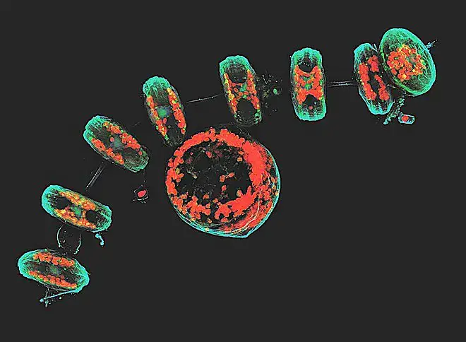 Confocal microscope image – This projection of multiple confocal images, taken at the EMBL light microscopy facility, shows a group of diatoms with cyan cell walls, red chloroplasts, blue DNA, and green membranes and organelles