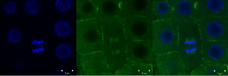 Confocal microscope image – Green signal from anti-tubulin antibody conjugated with Alexa Fluor 488) and nuclei (blue signal from DNA stained with DAPI) in root meristem cells 4-day-old Arabidopsis thaliana (Col-0). Scale bar: 5 um.