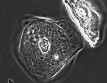 Appearance of Phase Contrast Images
