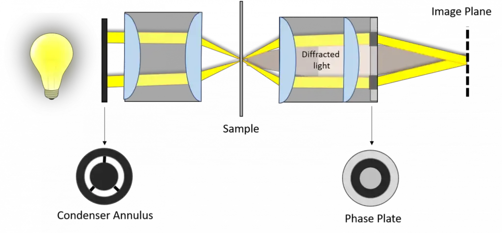 ight path of a phase-contrast microscope is depicted. The condenser diaphragm is replaced with a phase annulus, which lights the sample using the condenser optical elements to create a hollow light cone. At the back focal plane of the objective, a phase plate attenuates direct light (dark spots on the phase plate) and adds a 90° phase shift. The sample’s diffracted light will not pass through the phase ring attenuators (red haze), hence it will not be attenuated. All wavefronts will be recombined by the tube lens to create the phase image.