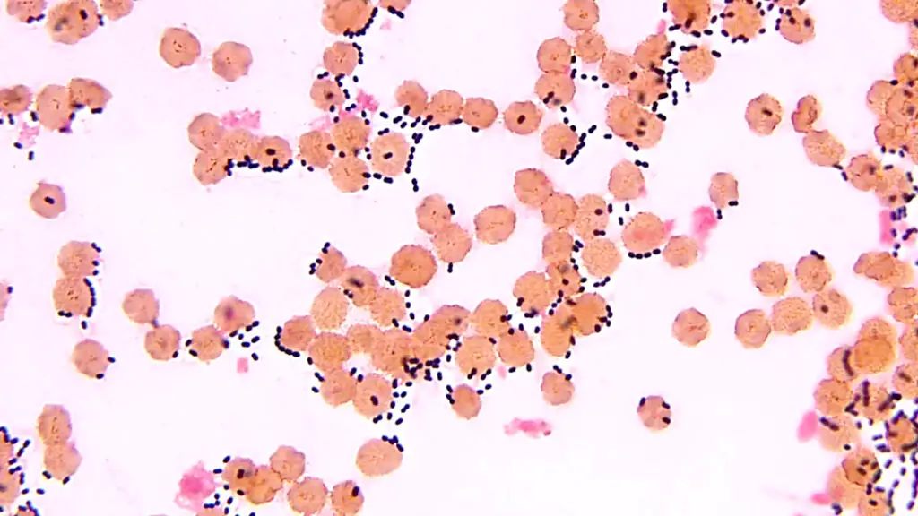 Streptococcus pneumoniae from blood sample Gram stained. Image showing encapsulated gram positive diplococci among erythrocytes.
Contributed by Sixto M. Leal, Jr., M.D., Ph.D.