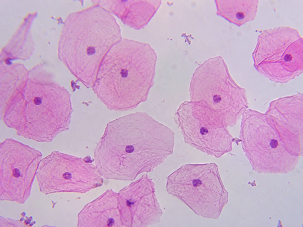 Onion Cells (Onion peel) Under a Microscope - Onion Epidermal Cell Wall 10 Cheek Cell Under Microscope