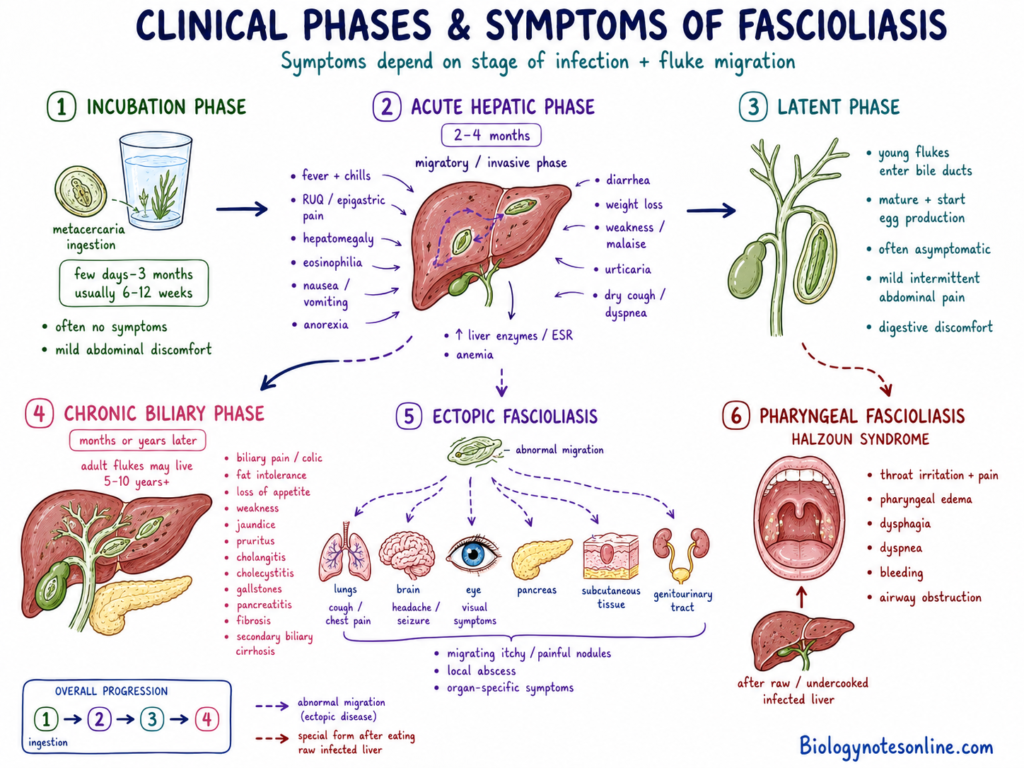 Illustration showing the Clinical Phases and Symptoms of Fascioliasis