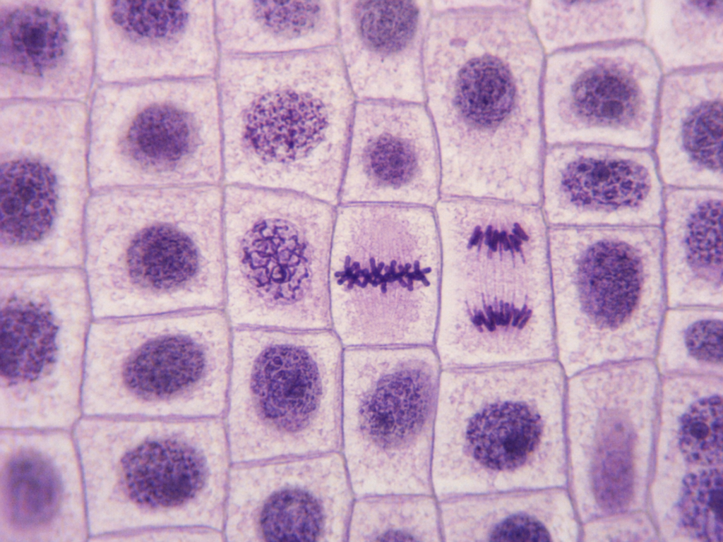 Microscopic image showing Metaphase in an Onion Root Tip