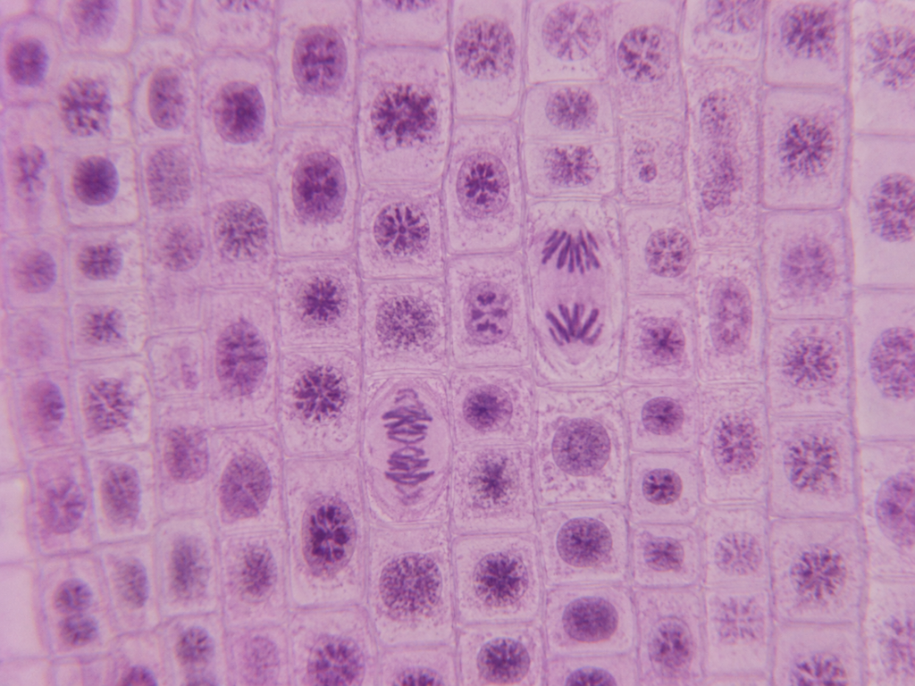 Onion Cells (Onion peel) Under a Microscope - Onion Epidermal Cell Wall 11 Onion Root Tip Cell Under Microscope