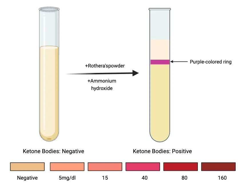 results of Rothera’s test