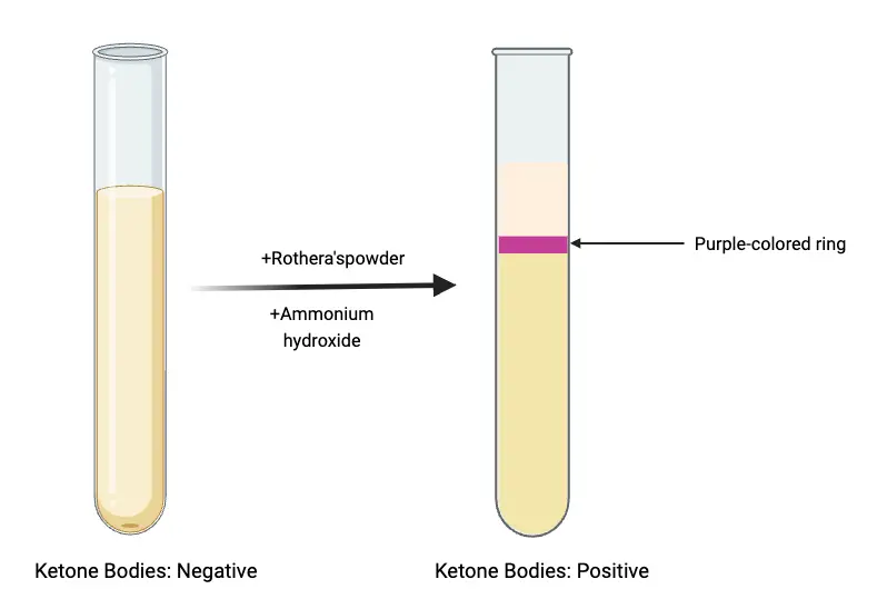 results of Rothera’s test