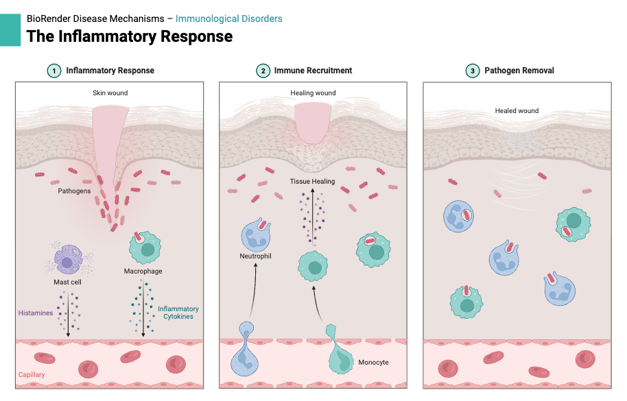 The Inflammatory Response
