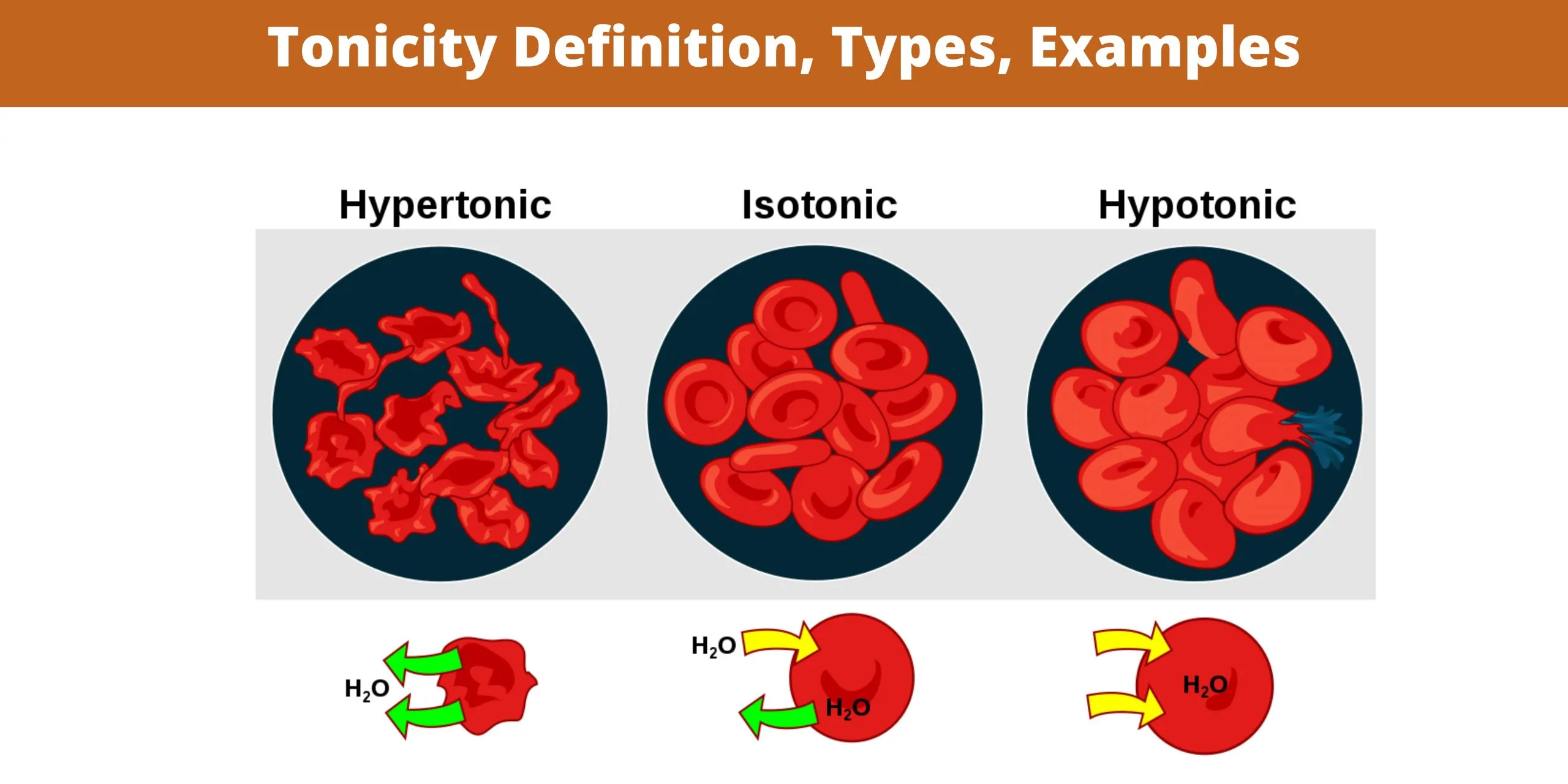 Tonicity Definition, Types, Examples