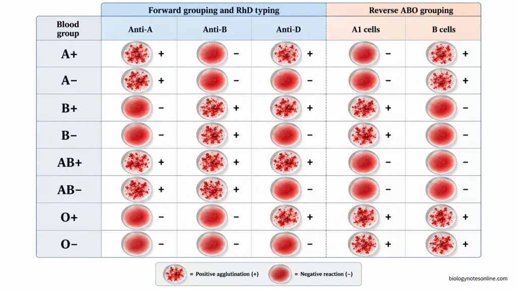 Blood grouping reaction chart for A+, A−, B+, B−, AB+, AB−, O+, and O− showing expected agglutination with anti-A, anti-B, anti-D, A1 cells, and B cells.