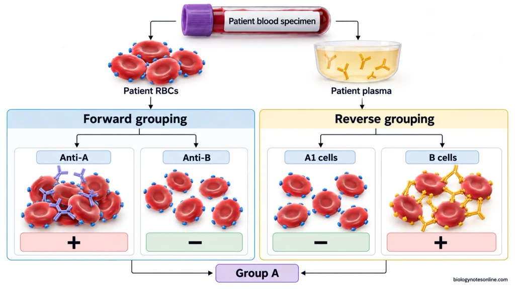Group A blood specimen tested by forward grouping with anti-A and anti-B reagents and by reverse grouping with known A1 and B red blood cells.