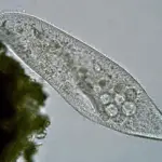Here is the picture of Paramecium Caudatum Under Microscope