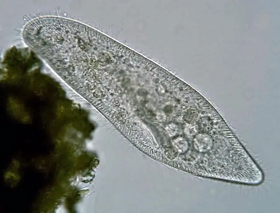 Here is the picture of Paramecium Caudatum Under Microscope

