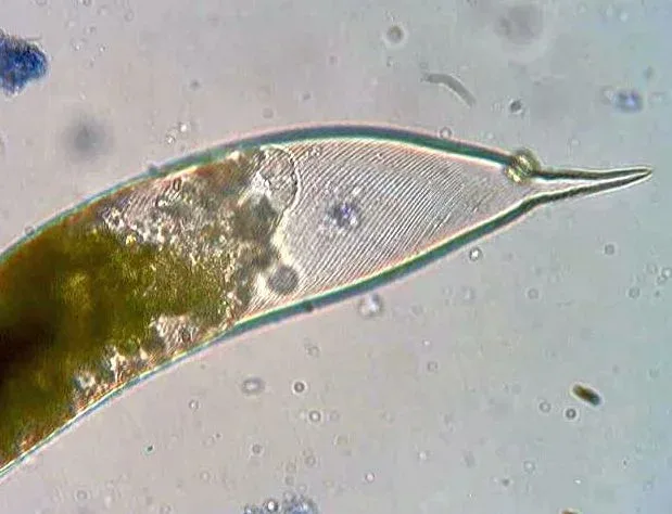 The striations seen on the right side are the pellicle, a proteinaceous coating found in euglenoids.
