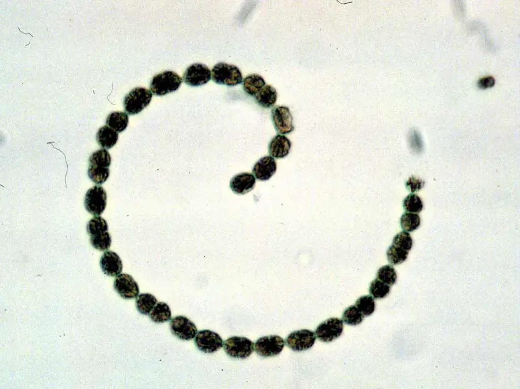 Anabaena flosaquae (Image Source: Environmental Protection Agency, Public domain, via Wikimedia Commons)
